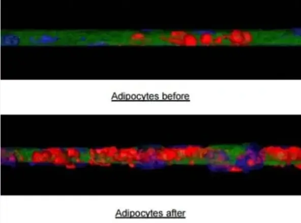Adipocytes